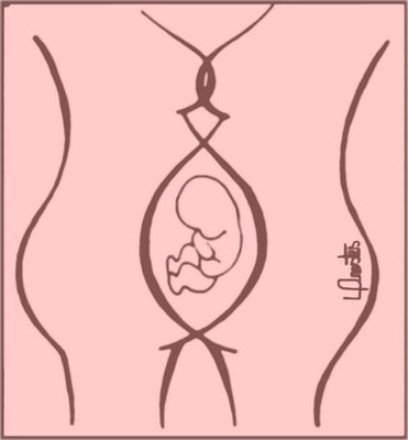 filha de lesbicas Ilustracao de duas mulheres gravidas, uma de frente para outra, as barrigas unidas e um feto dentro