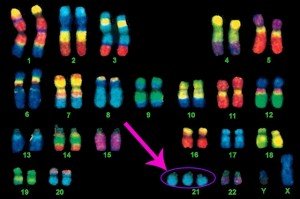 what-is-down-syndrome1 Em fundo preto, 22 pares de cromossomos coloridos. No número 21 aparecem 3 cr0mossomos.