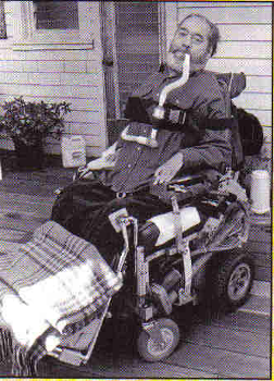 foto em preto e branco de Ed Robert, em cadeira de rodas e com respirador.
